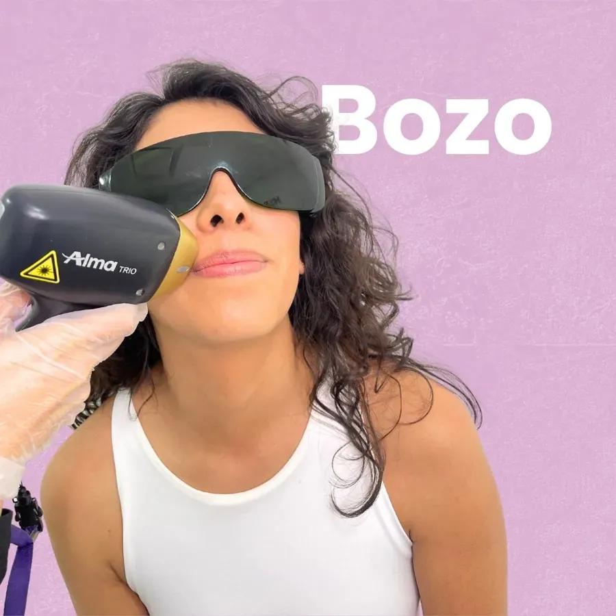 Depilación láser de bozo en HAPPYláser